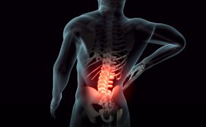 back pain image